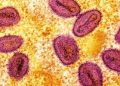 Senator pushes stricter health measures in schools vs mpox
