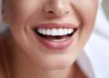 Transform Your Smile with Dental Implants Newcastle