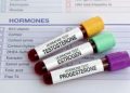 Vasectomy: a personal decision, but many pros and cons to consider