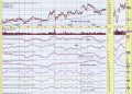 SP600 (IJR) Silver Cross BUY Signal May Arrive Too Late