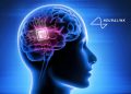 Can You Invest in Neuralink?